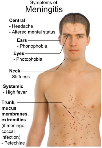 neck pain meningitis symptoms